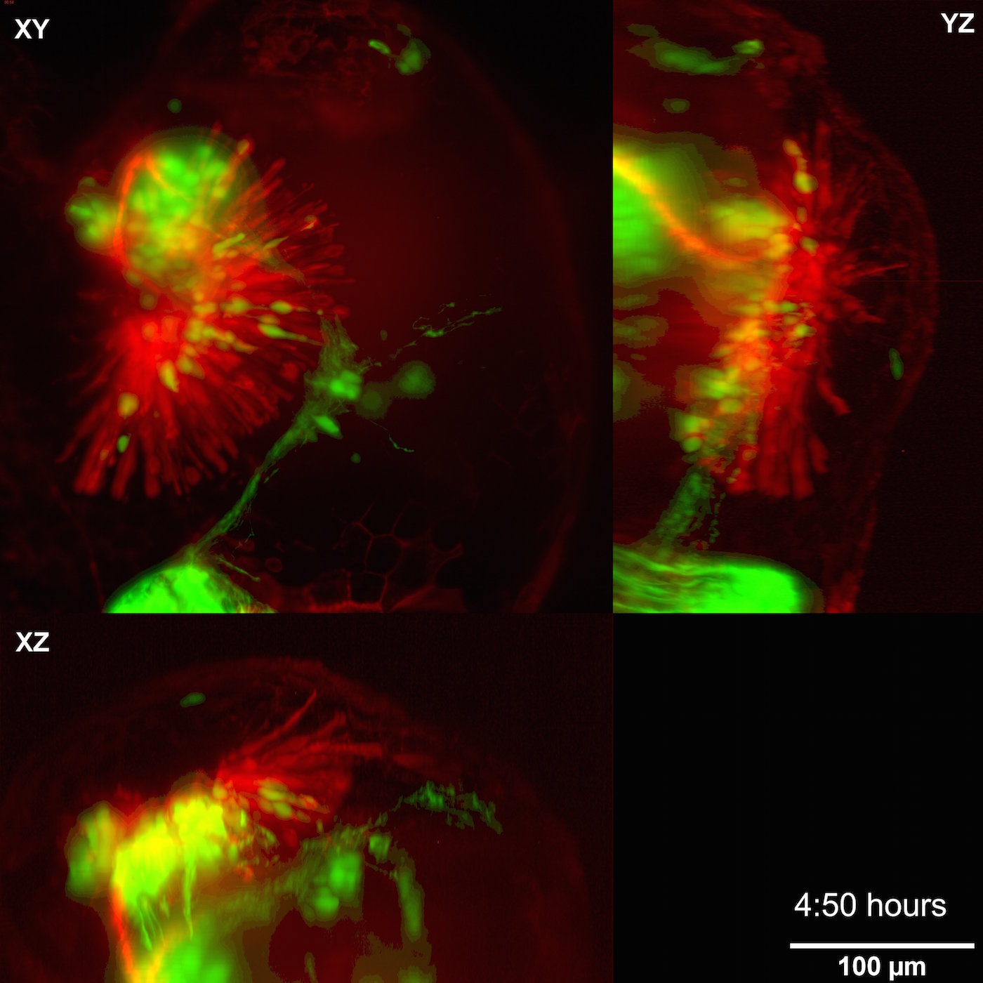 Zebrafish Eye, Light Sheet Imaging, 2 color, Max Int Projections, start @ 26hpf 's image