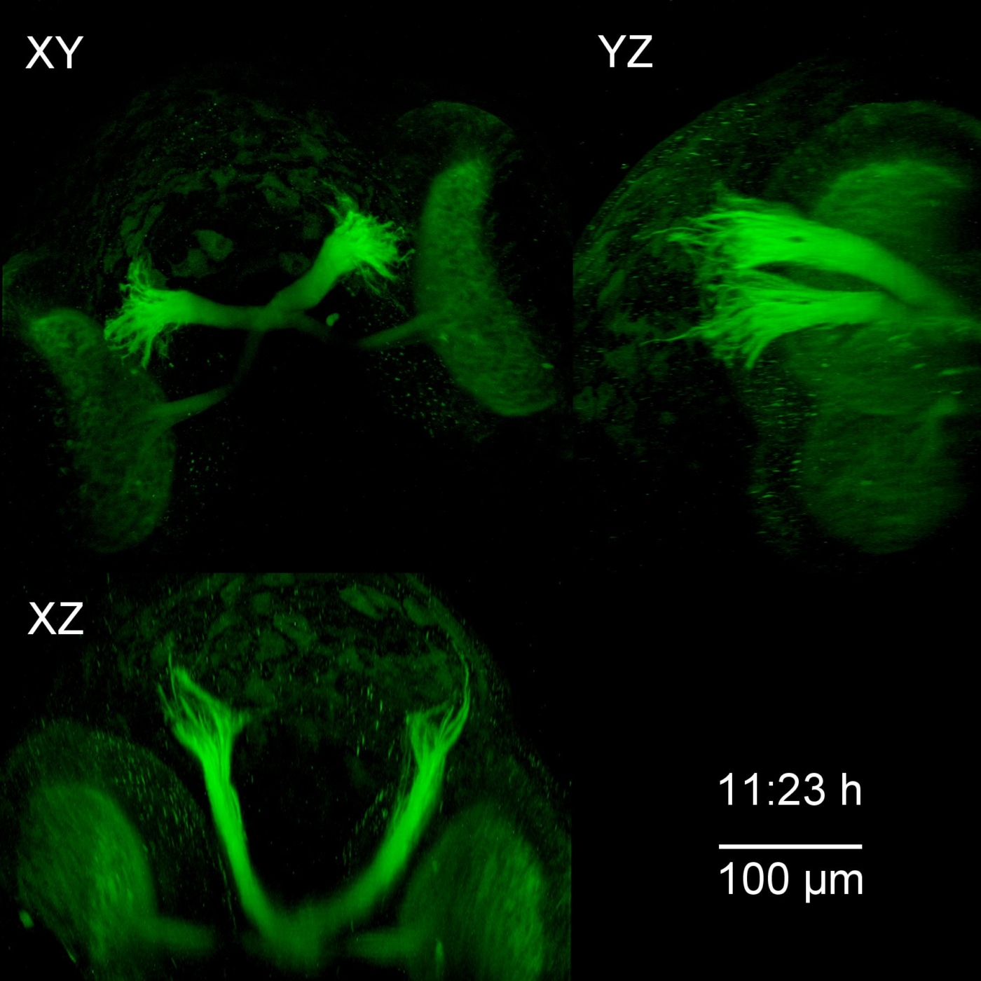 Zebrafish Eye, Multiphoton Imaging, Time Lapse's image