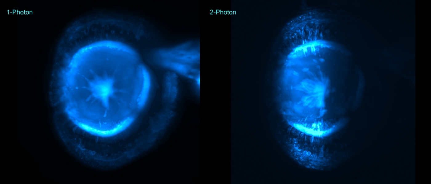Zebrafish Eye, Light Sheet Imaging, Comparison 2 Photon Excitation and 1 Photon excitation, 3d rendering's image
