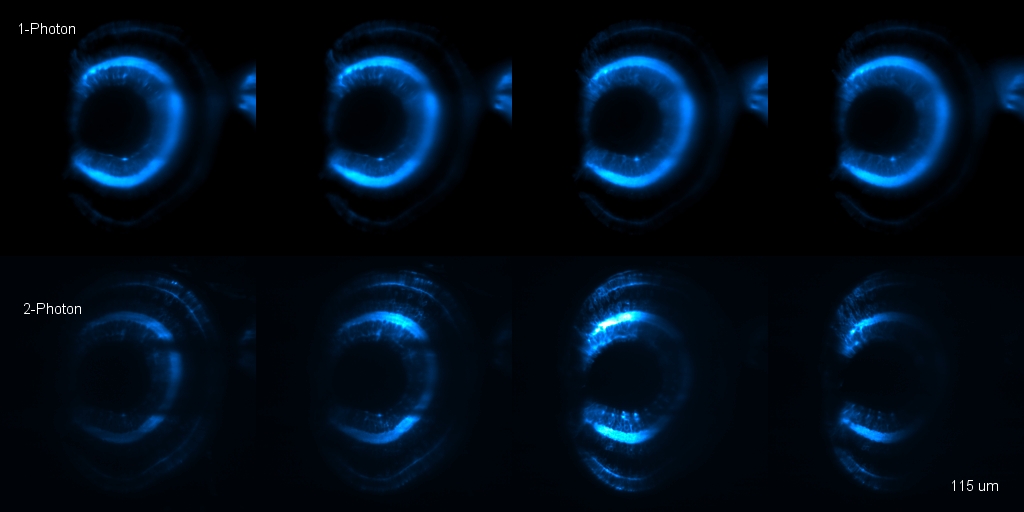 Zebrafish Eye, Light Sheet Imaging, Comparison 2 Photon Excitation 1 Photon excitatation, different lens settings's image