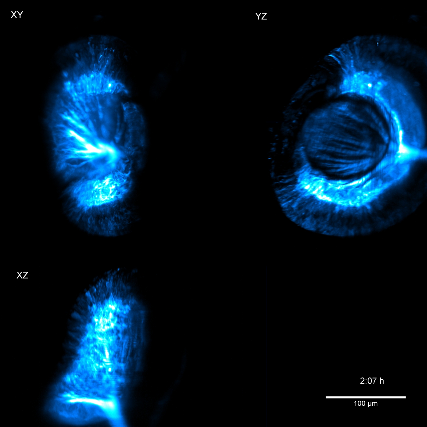 Zebrafish Eye, Light Sheet Imaging, 2-Photon Excitation, Maximum Intensity Projections, normalized's image