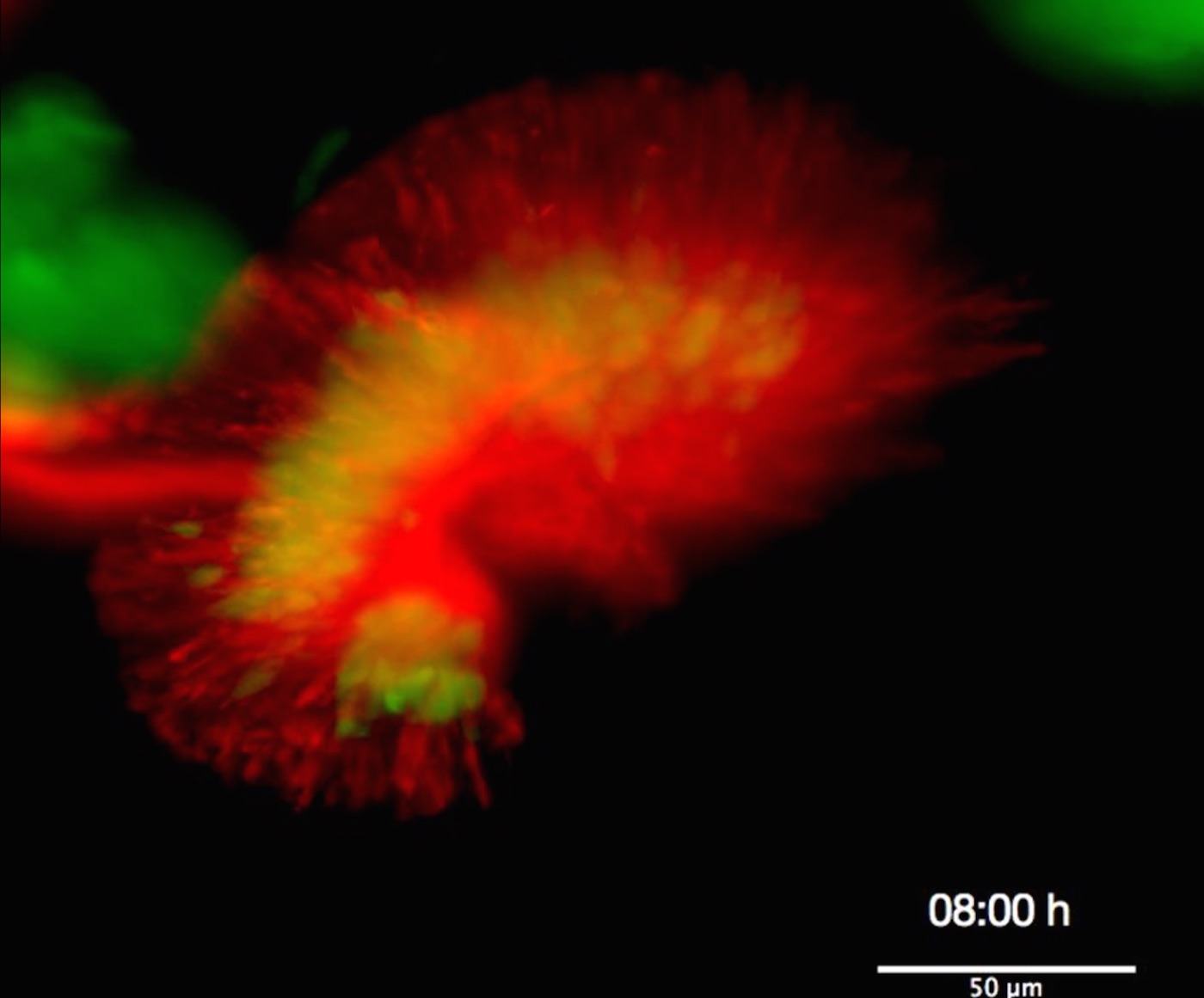 Zebrafish Eye, Light Sheet Imaging, 2 color, Time Lapse's image