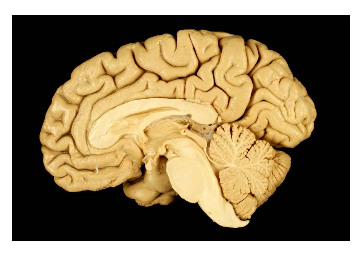 Neuroanatomy's image